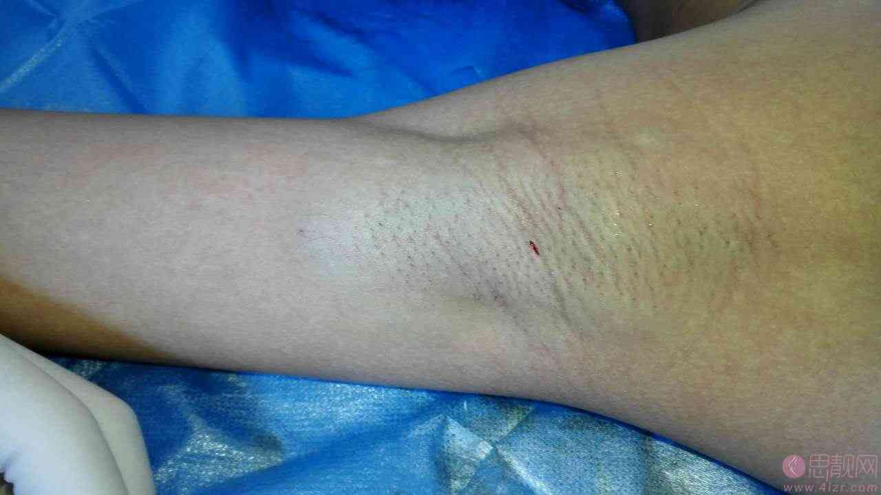 �����ݷ���Ƥ����ҽԺ"